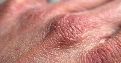 Eine Nahaufnahme der Hand einer Person.