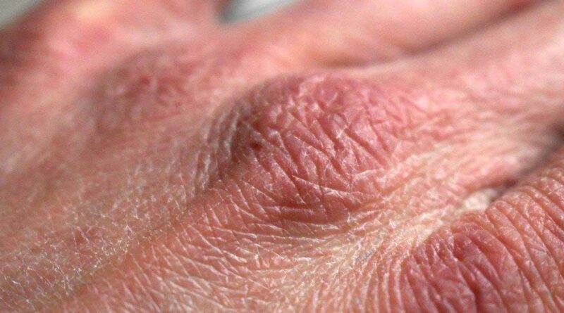 Eine Nahaufnahme der Hand einer Person.