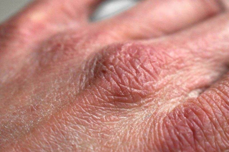 Eine Nahaufnahme der Hand einer Person.